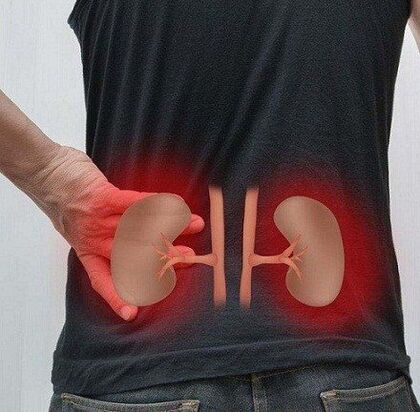 Low pain can occur in pyelonephritis
