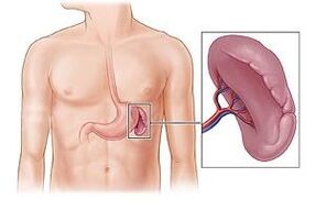 pathology of the spleen as the cause of pain under the left shoulder blade