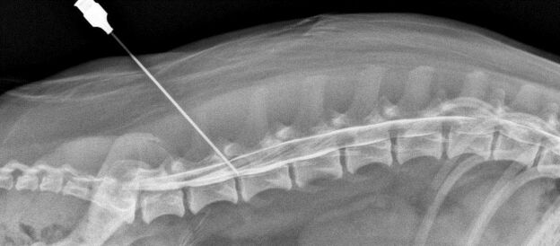 blockade of the spine with osteochondrosis