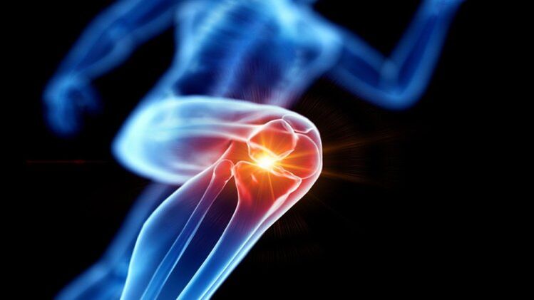 arthrosis of the knee joint